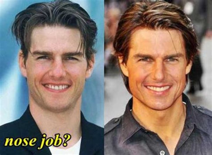 Did Tom Cruise Get a Nose Job?
