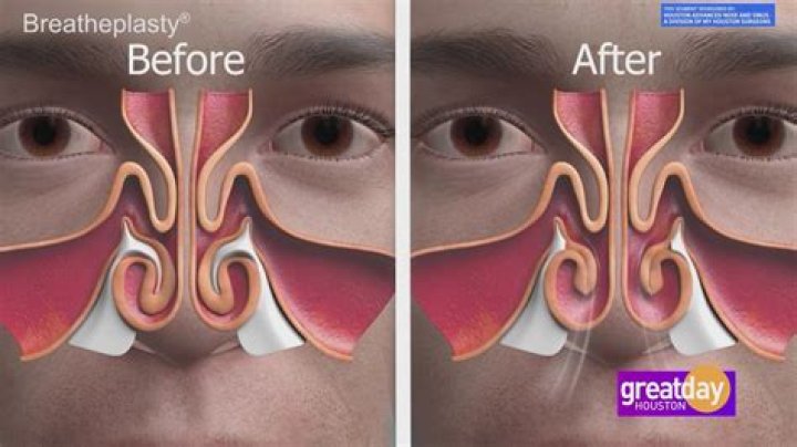 Temukan Makna Lirik "Bend Over Breathe Through Your Nose" Kevin Gates Yang Mencengangkan