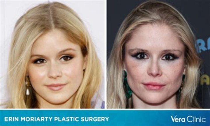 Unveiling The Truth Behind Olivia Casta's Plastic Surgery Rumors